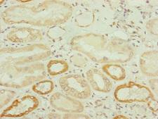 TWIST2 Antibody - Immunohistochemistry of paraffin-embedded human kidney tissue at dilution of 1:100
