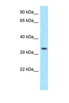 TWISTNB Antibody - TWISTNB antibody Western blot of HepG2 Cell lysate. Antibody concentration 1 ug/ml.  This image was taken for the unconjugated form of this product. Other forms have not been tested.