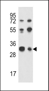TWISTNB Antibody - Western blot of RPA43 Antibody in Jurkat,K562 cell line lysates (35 ug/lane). RPA43 (arrow) was detected using the purified antibody.