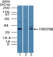 TWISTNB Antibody - Western blot of Twistnb in HeLa cell lysate in the 1) absence and 2) presence of immunizing peptide, and 3) mouse embryo body lysate using Polyclonal Antibody to Twistnb at 4 ug/ml. Goat anti-rabbit Ig HRP secondary antibody, and PicoTect ECL substrate solution were used for this test.