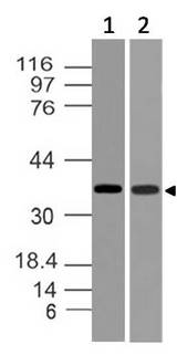 TWISTNB Antibody - Fig-1: Expression analysis of Twistnb. Anti-Twistnb antibody was used at 1 µg/ml on (1) HCT-116 and (2) h Kidney lysates.