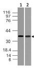 TWISTNB Antibody - Fig-1: Expression analysis of Twistnb. Anti-Twistnb antibody was used at 1 µg/ml on (1) HCT-116 and (2) h Kidney lysates.
