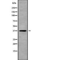 TWISTNB Antibody - Western blot analysis of TWISTNB using MCF-7 whole cells lysates