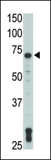 TXK / RLK Antibody - Western blot of anti-TXK antibody in Jurkat cell lysate. TXK (arrow) was detected using purified antibody. Secondary HRP-anti-rabbit was used for signal visualization with chemiluminescence.