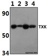 TXK / RLK Antibody - Western blot of TXK antibody at 1:500 dilution. Lane 1: Jurkat whole cell lysate (40 ug). Lane 2: The Spleen tissue lysate of Rat(30 ug). Lane 3: The Spleen tissue lysate of Mouse(30 ug). Lane 4: THP-1 whole cell lysate (40 ug).