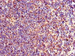 TXK / RLK Antibody - Immunohistochemistry of paraffin-embedded human lymph node tissue at dilution of 1:100
