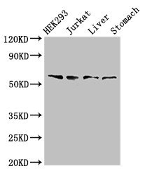 TXK / RLK Antibody - Western Blot Positive WB detected in:HEK293 whole cell lysate,Jurkat whole cell lysate,Rat liver tissue,Rat stomach tissue All Lanes:TXK antibody at 3µg/ml Secondary Goat polyclonal to rabbit IgG at 1/50000 dilution Predicted band size: 62 KDa Observed band size: 62 KDa