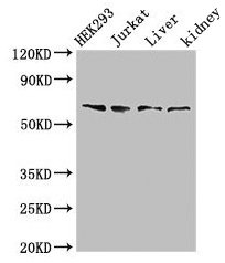 TXK / RLK Antibody - Western Blot Positive WB detected in: HEK293 whole cell lysate, Jurkat whole cell lysate, Rat liver tissue, Rat kidney tissue All lanes: TXK antibody at 3µg/ml Secondary Goat polyclonal to rabbit IgG at 1/50000 dilution Predicted band size: 62 kDa Observed band size: 62 kDa