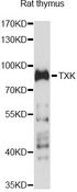 TXK / RLK Antibody - Western blot analysis of extracts of rat thymus, using TXK antibody at 1:1000 dilution. The secondary antibody used was an HRP Goat Anti-Rabbit IgG (H+L) at 1:10000 dilution. Lysates were loaded 25ug per lane and 3% nonfat dry milk in TBST was used for blocking. An ECL Kit was used for detection and the exposure time was 10s.
