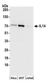 TXLNA / Alpha Taxilin Antibody - Detection of human IL14 by western blot. Samples: Whole cell lysate (50 µg) from HeLa, HEK293T, and Jurkat cells prepared using NETN lysis buffer. Antibodies: Affinity purified rabbit anti-IL14 antibody used for WB at 0.1 µg/ml. Detection: Chemiluminescence with an exposure time of 30 seconds.