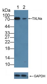 TXLNA / Alpha Taxilin Antibody - Knockout Varification: Lane 1: Wild-type K562 cell lysate; Lane 2: TXLNa knockout K562 cell lysate; Predicted MW: 62kd Observed MW: 75kd Primary Ab: 3µg/ml Rabbit Anti-Human TXLNa Antibody Second Ab: 0.2µg/mL HRP-Linked Caprine Anti-Rabbit IgG Polyclonal Antibody