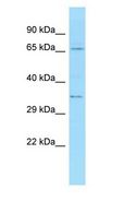 TXLNA / Alpha Taxilin Antibody - TXLNA / Alpha Taxilin antibody Western Blot of HeLa.  This image was taken for the unconjugated form of this product. Other forms have not been tested.