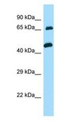 TXLNA / Alpha Taxilin Antibody - TXLNA / Alpha Taxilin antibody Western Blot of Jurkat.  This image was taken for the unconjugated form of this product. Other forms have not been tested.