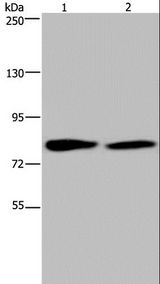 TXLNA / Alpha Taxilin Antibody - Western blot analysis of K562 and 293T cell, using TXLNA Polyclonal Antibody at dilution of 1:350.