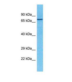 TXLNB Antibody - Western blot of Human MCF7. TXLNB antibody dilution 1.0 ug/ml.  This image was taken for the unconjugated form of this product. Other forms have not been tested.