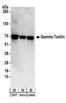 TXLNG Antibody - Detection of Human Gamma-Taxilin by Western Blot. Samples: Whole cell lysate (50 ug) from 293T, HeLa, and Jurkat cells. Antibodies: Affinity purified rabbit anti-Gamma-Taxilin antibody used for WB at 0.04 ug/ml. Detection: Chemiluminescence with an exposure time of 30 seconds.