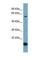 TXLNG Antibody - Western blot of Human PANC1. TXLNG antibody dilution 1.0 ug/ml.  This image was taken for the unconjugated form of this product. Other forms have not been tested.