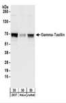TXLNG Antibody - Detection of Human Gamma-Taxilin by Western Blot. Samples: Whole cell lysate (50 ug) from 293T, HeLa, and Jurkat cells. Antibodies: Affinity purified rabbit anti-Gamma-Taxilin antibody used for WB at 0.1 ug/ml. Detection: Chemiluminescence with an exposure time of 10 seconds.