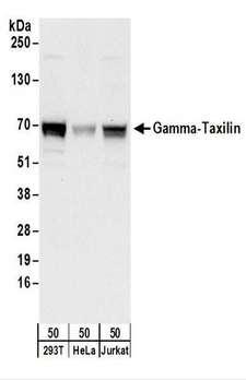 TXLNG Antibody - Detection of Human Gamma-Taxilin by Western Blot. Samples: Whole cell lysate (50 ug) from 293T, HeLa, and Jurkat cells. Antibodies: Affinity purified rabbit anti-Gamma-Taxilin antibody used for WB at 0.1 ug/ml. Detection: Chemiluminescence with an exposure time of 10 seconds.