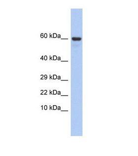 TXLNG Antibody - Western blot of Human Fetal Lung. TXLNG antibody dilution 1.0 ug/ml.  This image was taken for the unconjugated form of this product. Other forms have not been tested.
