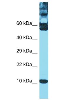 TXN / Thioredoxin / TRX Antibody - TXN / Thioredoxin / TRX antibody Western Blot of MCF7. Antibody dilution: 1 ug/ml.  This image was taken for the unconjugated form of this product. Other forms have not been tested.