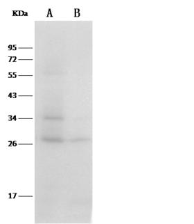 TXN / Thioredoxin / TRX Antibody - Anti-Txn rabbit monoclonal antibody at 1:500 dilution. Lane A: Hela Whole Cell Lysate. Lane B: A431 Whole Cell Lysate. Lysates/proteins at 30 ug per lane. Secondary: Goat Anti-Rabbit IgG (H+L)/HRP at 1/10000 dilution. Developed using the ECL technique. Performed under reducing conditions. Predicted band size: 27 kDa. Observed band size: 27 kDa.