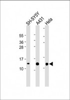 TXN / Thioredoxin / TRX Antibody - All lanes: Anti-TXN at 1:2000 dilution Lane 1: SH-SY5Y whole cell lysate Lane 2: A431 whole cell lysate Lane 3: Hela whole cell lysate Lysates/proteins at 20 µg per lane. Secondary Goat Anti-mouse IgG, (H+L), Peroxidase conjugated at 1/10000 dilution. Predicted band size: 12 kDa Blocking/Dilution buffer: 5% NFDM/TBST.