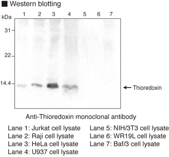 TXN / Thioredoxin / TRX Antibody