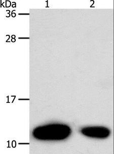 TXN / Thioredoxin / TRX Antibody - Western blot analysis of HeLa cell and human liver cancer tissue, using TXN Polyclonal Antibody at dilution of 1:700.