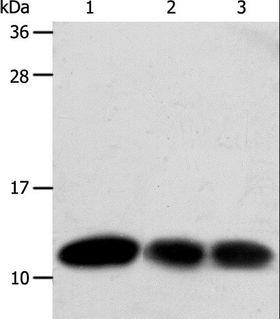 TXN / Thioredoxin / TRX Antibody - Western blot analysis of HeLa and MCF7 cell, human liver cancer tissue, using TXN Polyclonal Antibody at dilution of 1:600.