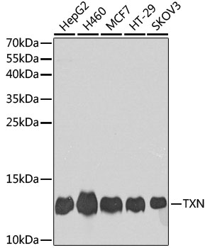TXN / Thioredoxin / TRX Antibody - Western blot analysis of extracts of various cell lines, using TXN antibody at 1:1000 dilution. The secondary antibody used was an HRP Goat Anti-Rabbit IgG (H+L) at 1:10000 dilution. Lysates were loaded 25ug per lane and 3% nonfat dry milk in TBST was used for blocking. An ECL Kit was used for detection and the exposure time was 90s.