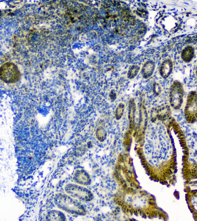 TXN / Thioredoxin / TRX Antibody - IHC analysis of Thioredoxin TRX using anti-Thioredoxin TRX antibody. Thioredoxin TRX was detected in paraffin-embedded section of mouse small intestine tissue. Heat mediated antigen retrieval was performed in citrate buffer (pH6, epitope retrieval solution) for 20 mins. The tissue section was blocked with 10% goat serum. The tissue section was then incubated with 1µg/ml rabbit anti-Thioredoxin TRX Antibody overnight at 4°C. Biotinylated goat anti-rabbit IgG was used as secondary antibody and incubated for 30 minutes at 37°C. The tissue section was developed using Strepavidin-Biotin-Complex (SABC) with DAB as the chromogen.