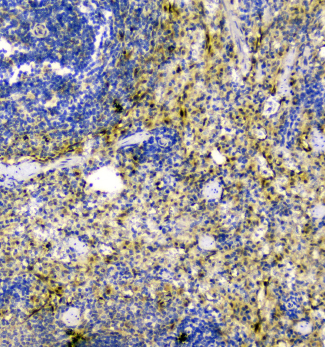 TXN / Thioredoxin / TRX Antibody - IHC analysis of Thioredoxin TRX using anti-Thioredoxin TRX antibody. Thioredoxin TRX was detected in paraffin-embedded section of rat spleen tissue. Heat mediated antigen retrieval was performed in citrate buffer (pH6, epitope retrieval solution) for 20 mins. The tissue section was blocked with 10% goat serum. The tissue section was then incubated with 1µg/ml rabbit anti-Thioredoxin TRX Antibody overnight at 4°C. Biotinylated goat anti-rabbit IgG was used as secondary antibody and incubated for 30 minutes at 37°C. The tissue section was developed using Strepavidin-Biotin-Complex (SABC) with DAB as the chromogen.