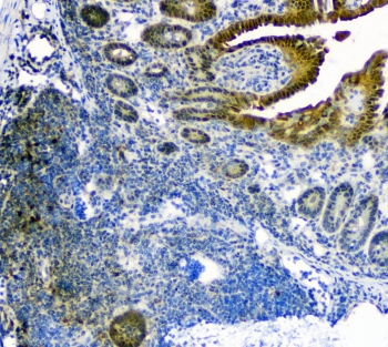 TXN / Thioredoxin / TRX Antibody - IHC staining of FFPE mouse small intestine with TRX antibody at 1ug/ml. HIER: boil tissue sections in pH6, 10mM citrate buffer, for 10-20 min followed by cooling at RT for 20 min.