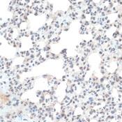 TXN / Thioredoxin / TRX Antibody - Immunohistochemistry of paraffin-embedded Rat lung using TXN Polyclonal Antibody at dilution of 1:100 (40x lens).