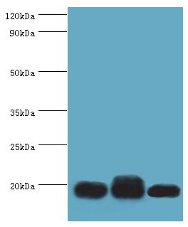 TXN2 / Thioredoxin 2 Antibody - Western blot. All lanes: Thioredoxin, mitochondrial antibody at 3 ug/ml. Lane 1: mouse liver tissue. Lane 2: rat brain tissue. Lane 3: mouse kidney tissue. secondary Goat polyclonal to rabbit at 1:10000 dilution. Predicted band size: 18 kDa. Observed band size: 18 kDa.