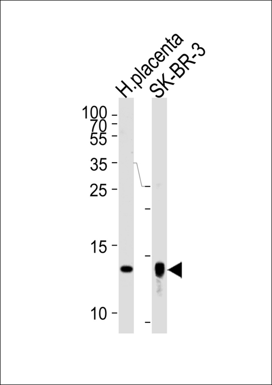 TXN2 / Thioredoxin 2 Antibody - Western blot of lysates from human placenta tissue lysate, SK-BR-3 cell line (from left to right), using Trx2 Antibody (I151). Antibody was diluted at 1:1000 at each lane. A goat anti-rabbit IgG H&L (HRP) at 1:5000 dilution was used as the secondary antibody. Lysates at 35ug per lane.