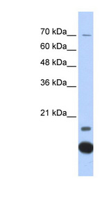 TXN2 / Thioredoxin 2 Antibody - TXN2 / Thioredoxin 2 antibody western blot of Transfected 293T cell lysate.  This image was taken for the unconjugated form of this product. Other forms have not been tested.