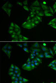 TXN2 / Thioredoxin 2 Antibody - Immunofluorescence analysis of U2OS cells using TXN2 antibody. Blue: DAPI for nuclear staining.