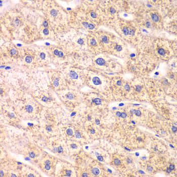 TXN2 / Thioredoxin 2 Antibody - Immunohistochemistry of paraffin-embedded human liver injury using TXN2 antibody at dilution of 1:100 (40x lens).