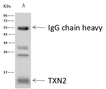 TXN2 / Thioredoxin 2 Antibody - KRT18 was immunoprecipitated using: Lane A: 0.5 mg A431 Whole Cell Lysate. 4 uL anti-KRT18 rabbit polyclonal antibody and 60 ug of Immunomagnetic beads Protein A/G. Primary antibody: Anti-KRT18 rabbit polyclonal antibody, at 1:100 dilution. Secondary antibody: Clean-Blot IP Detection Reagent (HRP) at 1:1000 dilution. Developed using the ECL technique. Performed under reducing conditions. Predicted band size: 48 kDa. Observed band size: 43 kDa.