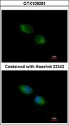 TXNDC1 / TMX1 Antibody - Immunofluorescence of methanol-fixed HeLa using TXNDC1 antibody at 1:500 dilution.