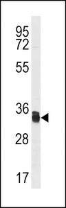 TXNDC1 / TMX1 Antibody - TMX1 Antibody western blot of Jurkat cell line lysates (35 ug/lane). The TMX1 antibody detected the TMX1 protein (arrow).