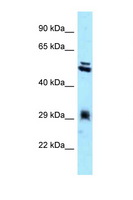 TXNDC1 / TMX1 Antibody - TMX1 / TXNDC antibody Western blot of HepG2 Cell lysate. Antibody concentration 1 ug/ml.  This image was taken for the unconjugated form of this product. Other forms have not been tested.