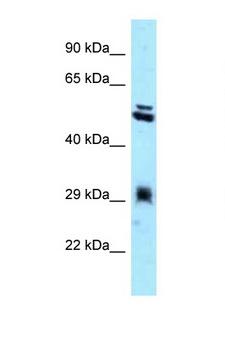 TXNDC1 / TMX1 Antibody - TMX1 / TXNDC antibody Western blot of HepG2 Cell lysate. Antibody concentration 1 ug/ml.  This image was taken for the unconjugated form of this product. Other forms have not been tested.