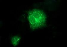 TXNDC1 / TMX1 Antibody - Anti-TMX1 mouse monoclonal antibody immunofluorescent staining of COS7 cells transiently transfected by pCMV6-ENTRY TMX1.