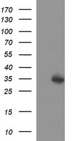 TXNDC1 / TMX1 Antibody - HEK293T cells were transfected with the pCMV6-ENTRY control (Left lane) or pCMV6-ENTRY TMX1 (Right lane) cDNA for 48 hrs and lysed. Equivalent amounts of cell lysates (5 ug per lane) were separated by SDS-PAGE and immunoblotted with anti-TMX1.