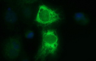 TXNDC1 / TMX1 Antibody - Anti-TMX1 mouse monoclonal antibody immunofluorescent staining of COS7 cells transiently transfected by pCMV6-ENTRY TMX1.