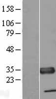TXNDC1 / TMX1 Protein - Western validation with an anti-DDK antibody * L: Control HEK293 lysate R: Over-expression lysate