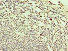 TXNDC11 Antibody - Immunohistochemistry of paraffin-embedded human small intestine tissue using antibody at dilution of 1:100.